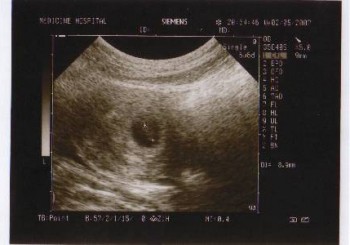 Ultrasonografi güvenli midir?