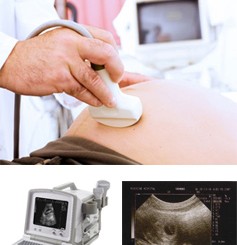 Jinekolojik Renkli Doppler Ultrason